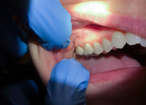 Best Urgent Tooth Repair  in Niagara, WI