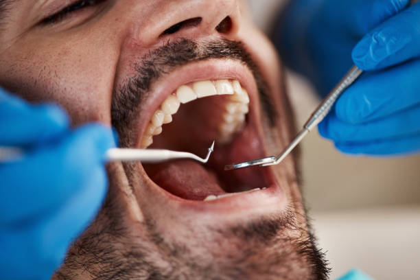 Best Dentist for Tooth Abscess  in Niagara, WI